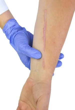 img_11__cellules-souches