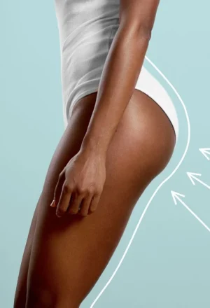 img_2__brazilian-butt-lift