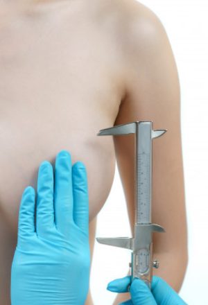 img_2__lifting-mammaire-avec-sans-protheses