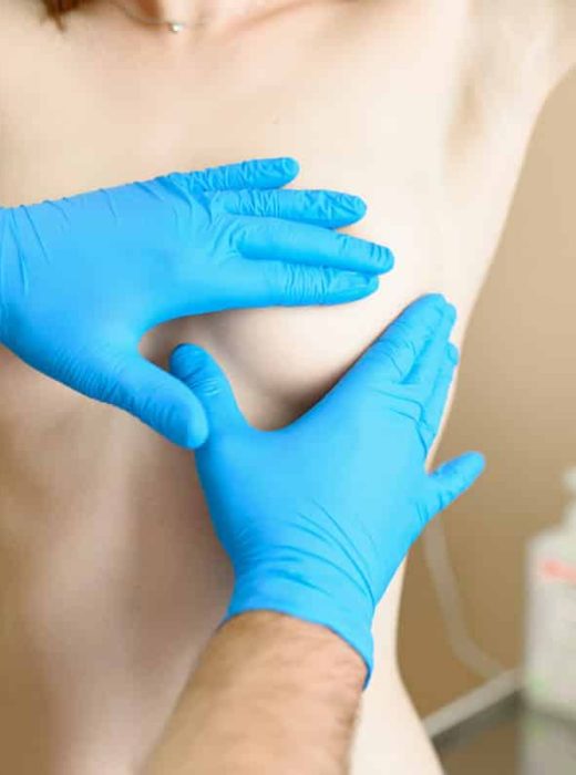 img__1__lifting-mammaire-avec-sans-protheses