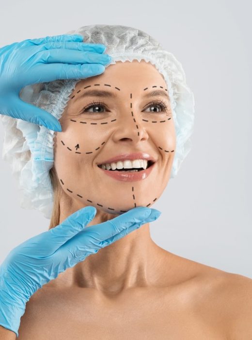 lipofilling-visage___33